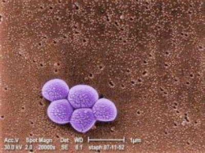 Superbugs in the hospitals