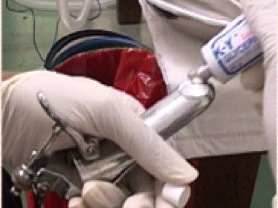 New guidelines for women: Have a pap test every 3 years